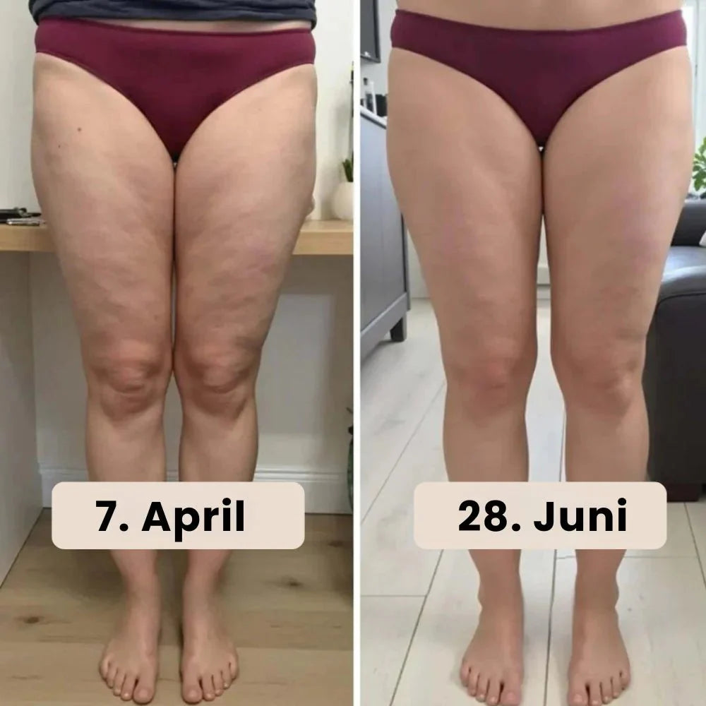 Helisandre - Seamless Anti-Cellulite Leggings
